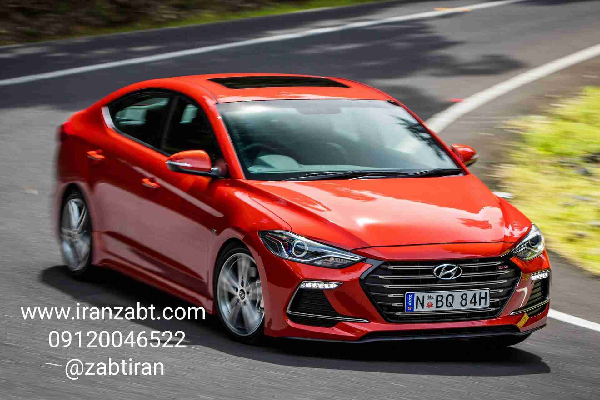 تعمیر ضبط هیوندا النترا در تهران